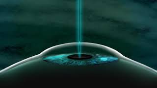 Trembles of Fortune - 02 - Tuesday Morning