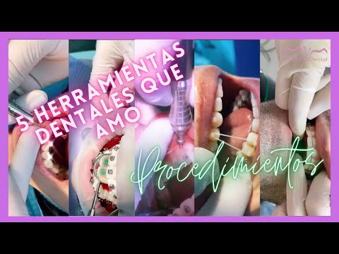 Mis 5 secretos en consulta!