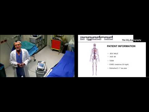 Challenging case done by Dr. Roberto Ferraresi  using Luminor DCB.