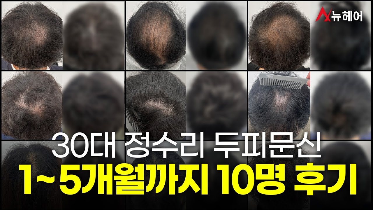 郑秀利脱母吧！头发多看很多