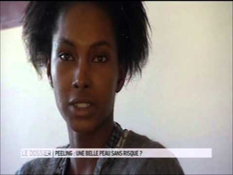 comment appliquer kelo cote
