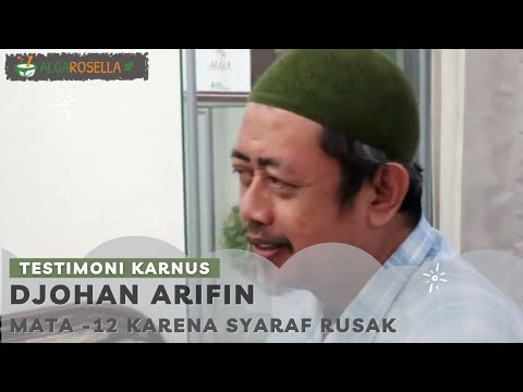 Mata Minus 12, Dokter Bilang Syaraf Rusak, Kembali Normal dengan Alga Series