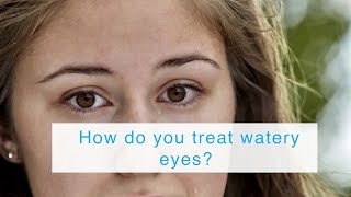 How do you treat watery eyes?