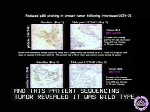 Targeting Chk1 in Breast Cancer