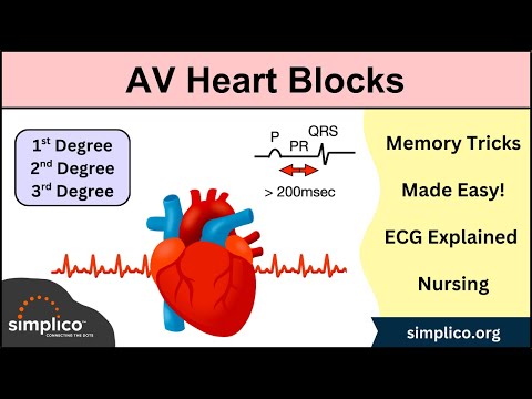 AV Heart Blocks Made Easy | 1st, 2nd, 3rd Degree [ECG Interpretation Explained]
