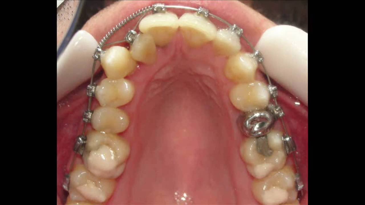 Maximiliano J. Lombardi-7