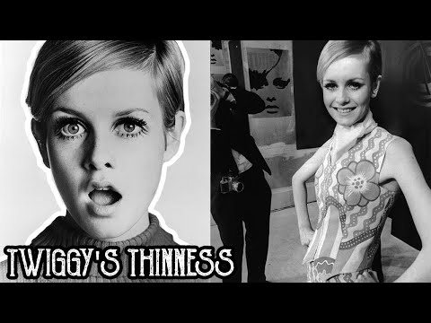 Is it Really Twiggy’s Fault That Thinness Became Fashionable?