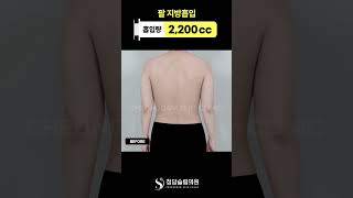 팔 라인… 차이 보임? ✨