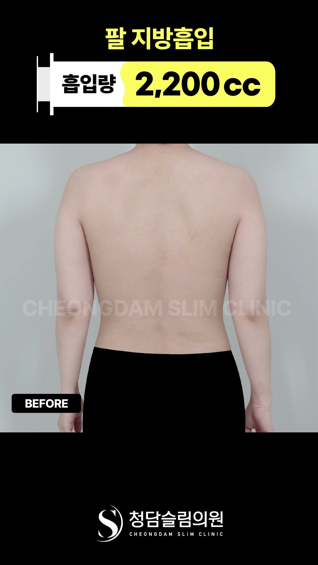 팔 라인… 차이 보임? ✨