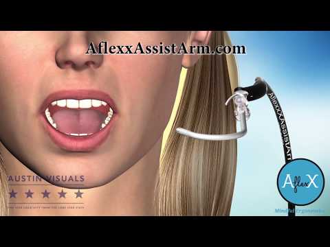 AflexX Assist Arm - Customer Success Story