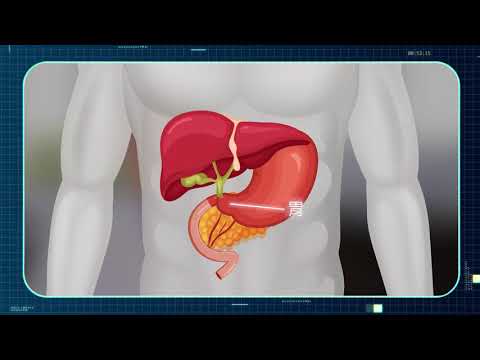 <h2><span style="font-size:18px;"><strong>光田第四代Xi達文西手術系統(da Vinci Xi Surgical System)-胰臟及十二指腸重建與切除</strong></span></h2><p>❗沒有最好 只有更好🎯<br>胰臟及十二指腸切除屬一般外科難度高的手術之一<br>#胰臟癌 #十二指腸癌 #總膽管癌<br>這些腫瘤位置分布在人體器官最密集、最浮皺之處<br>#一般外科楊耀坤醫師 深度解析<br>達文西機械手臂如何輔助醫師為患者帶來優越的治療效果</p><p>光田第四代Xi達文西手術系統<br>(da Vinci Xi Surgical System)<br>能執行一般內視鏡無法施行的高複雜度手術<br>10倍放大3D立體影像避免傷及血管與神經<br>手術更安全，精準度大幅提昇<br>傷口小、疼痛少、出血少、復原快</p><p>瞭解更多光田達文西微創手術中心</p>
