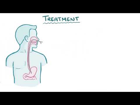 Superior Mesentric Artery Syndrome | Osmosis