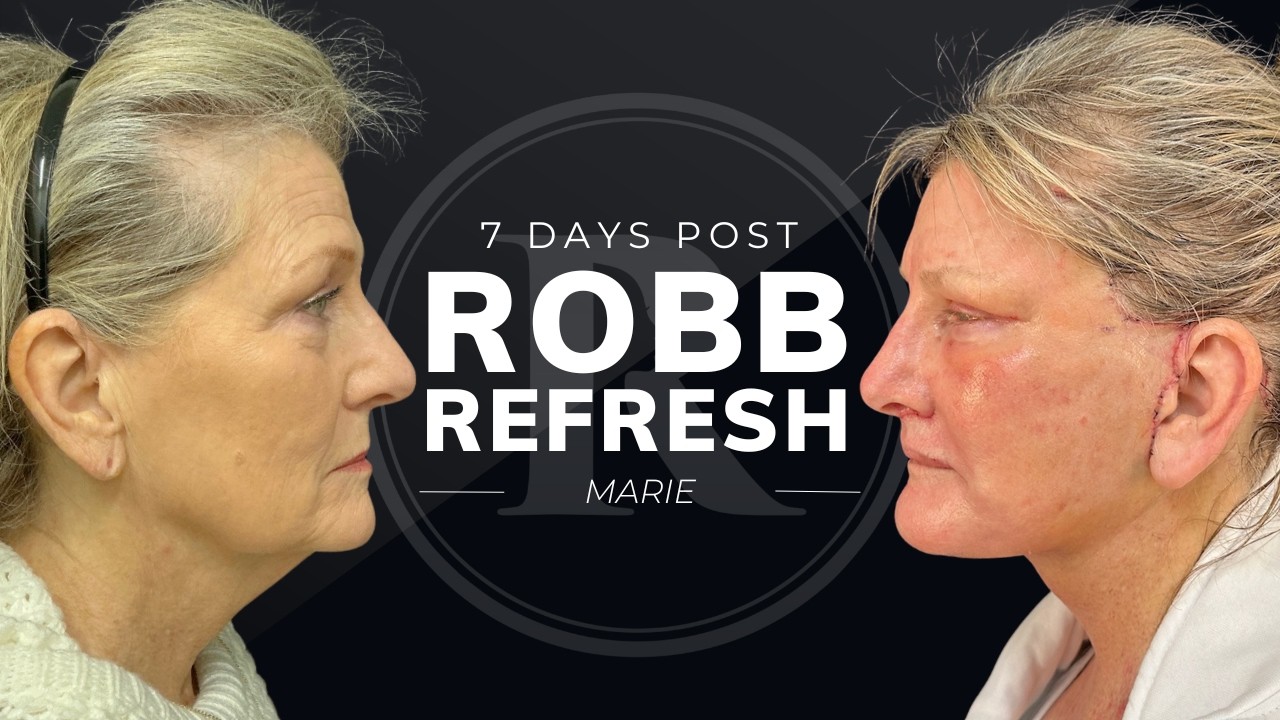 Robb Facial Plastic Surgery