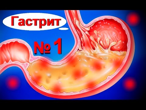 Дона уколы в сустав цена Болит большой палец в суставе на руке