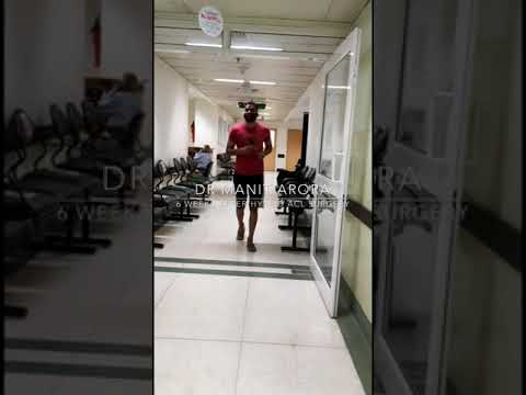 Im jogging 6 weeks after my hybrid ACL surgery!!! Thanks Dr Manit Arora