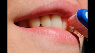 Sangrado en las encías: puede ser grave y hasta afectar el corazón | Noticias Caracol