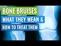 Bone Bruising in the Knee - Causes, Symptoms, and Treatment