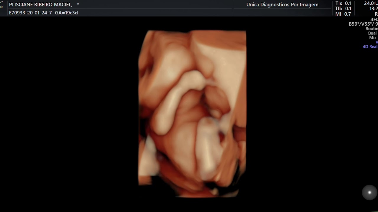IMAGENS EM 4D DE UM BEBE DE 19 SEMANAS