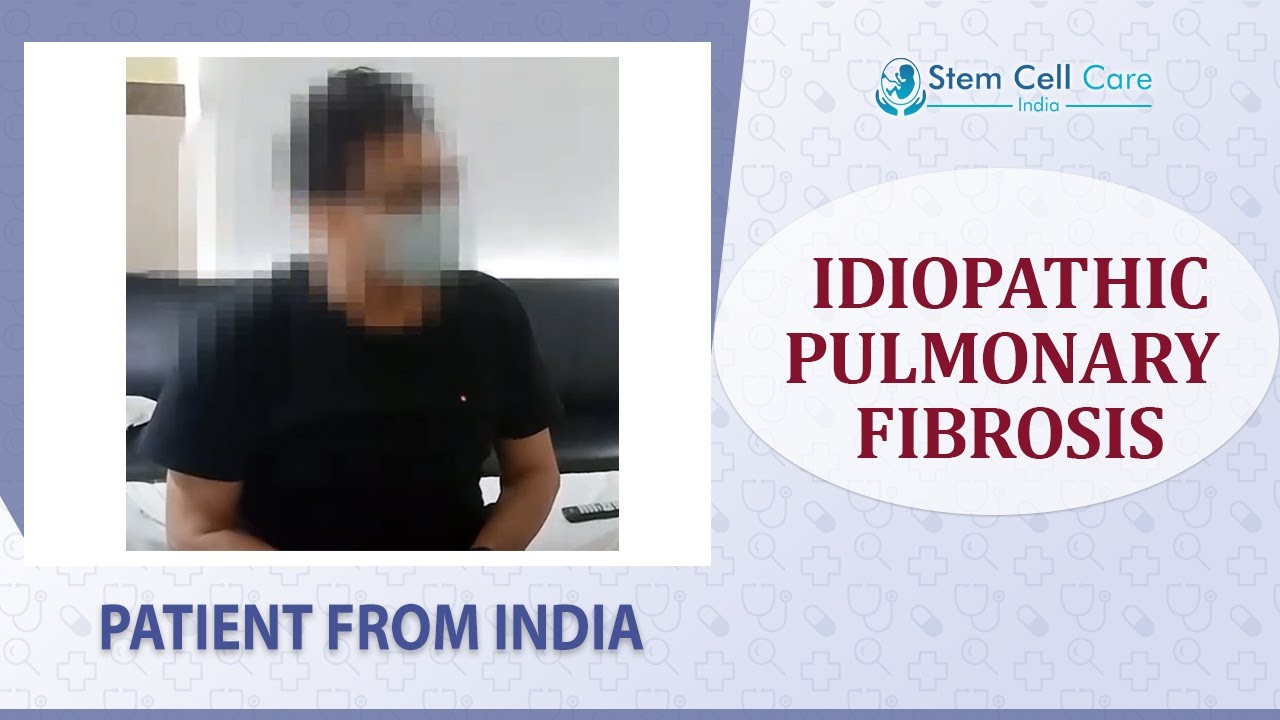 Patient with Idiopathic Pulmonary Fibrosis shares his experience at SCCI| ILD treatment| stem cells