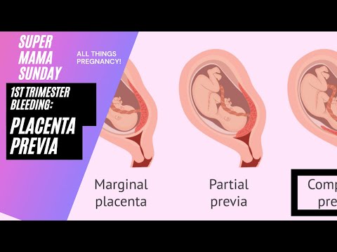 Bleeding in Pregnancy: Placenta Previa
