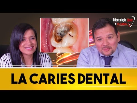 ELIMINAR LA CARIES DENTAL SIN FRESA