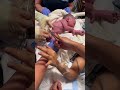 Our Firstborn Umbilical Cord Cutting Newborn Umbilicalcord Newparents Babies Baby Babyboy