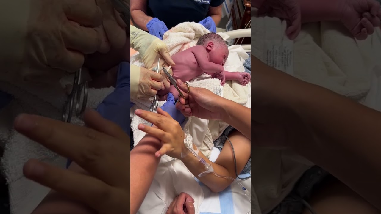 Our firstborn umbilical cord cutting. #newborn  #umbilicalcord  #newparents  #babies #baby  #babyboy