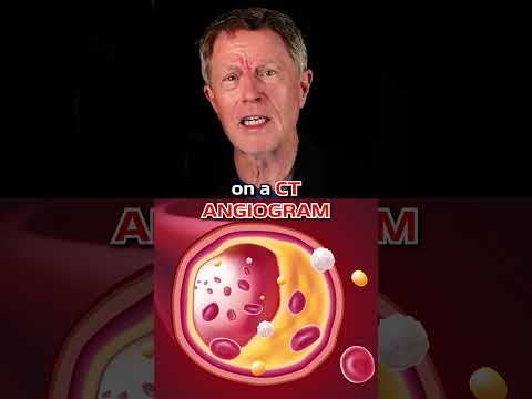 The Truth About LDL-Cholesterol: New Evidence