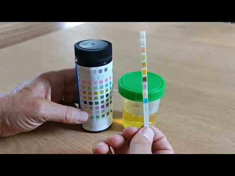How to use urine test strips 10 parameters