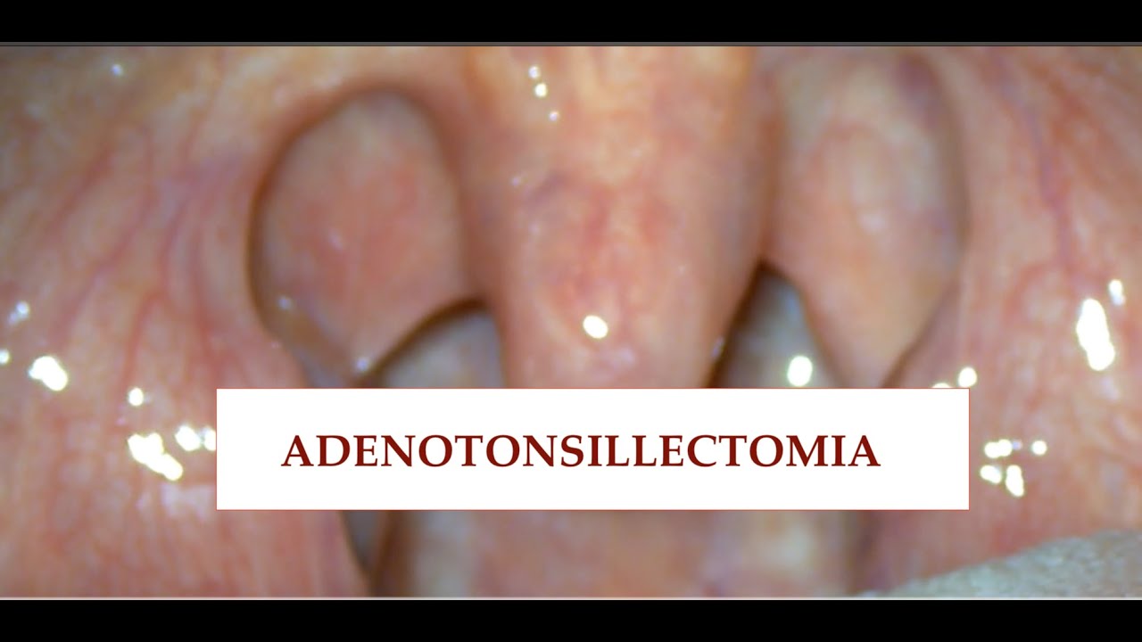 Giuseppe Castellana-10