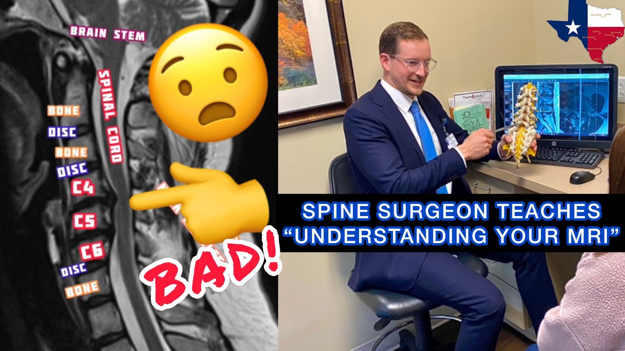How to Read Your Spine MRI (Pinched Nerves, Cord Compression)