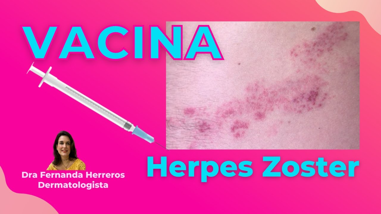 Tudo sobre a Vacina Para Herpes Zoster - Novidades
