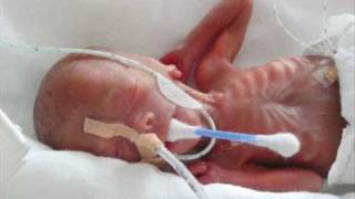 Meine Mutter Raucht Während Der Schwangerschaft Was Soll Ich