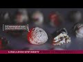 Consider The Walnut Loma Linda University