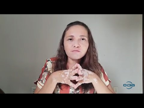 Professora telespectadora do Bom Dia News dá depoimento sobre a vivência com o vitiligo 04 02 2022