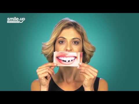 Implantologia dentária nas clínicas Smile.up