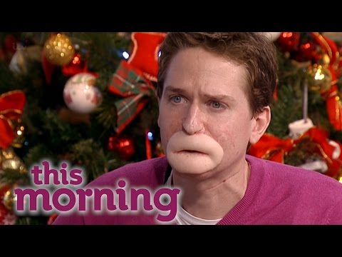 Alex Lewis' Goal To Walk Down The Aisle | This Morning