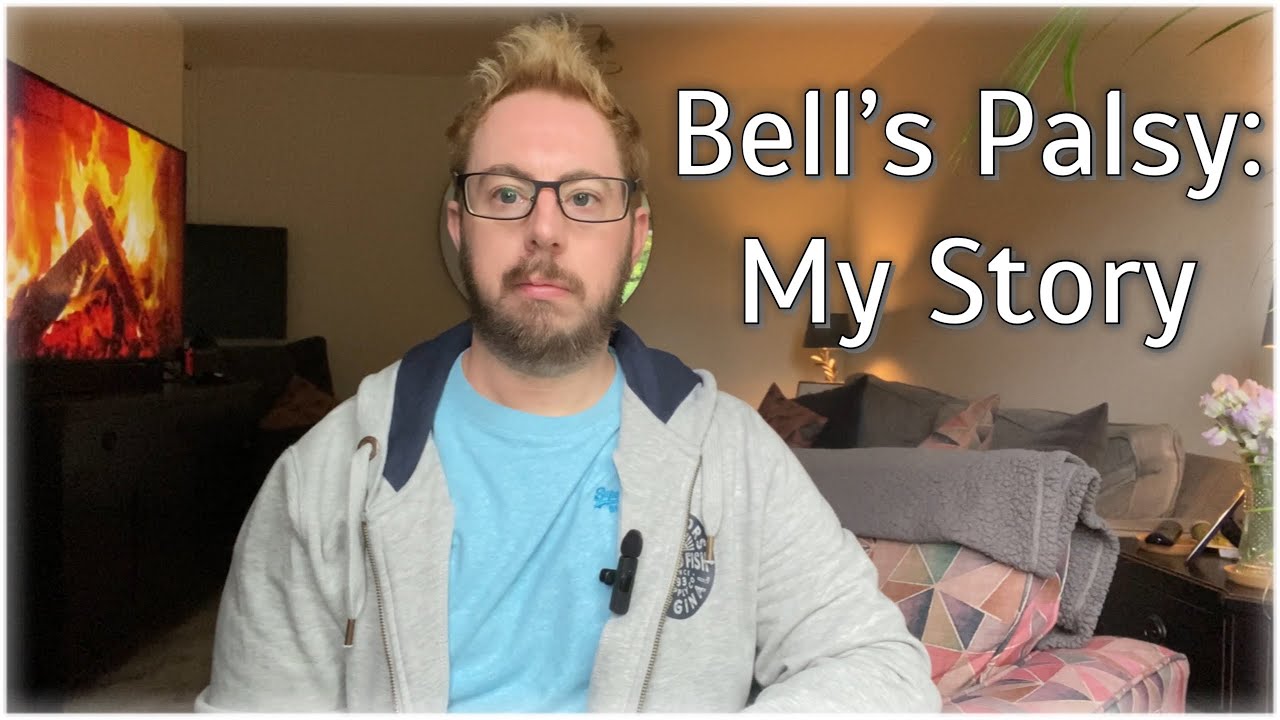 Bell's Palsy (Facial Paralysis) : My Story