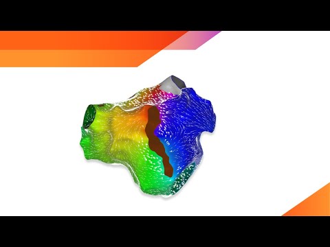 About Johnson & Johnson MedTech | Electrophysiology