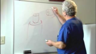 preview picture of video 'Tubal Ligation Reversal - Lakeshore Surgical Center Gainesville GA'