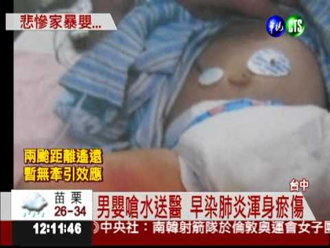 男嬰嗆水送醫 全身瘀傷疑受虐