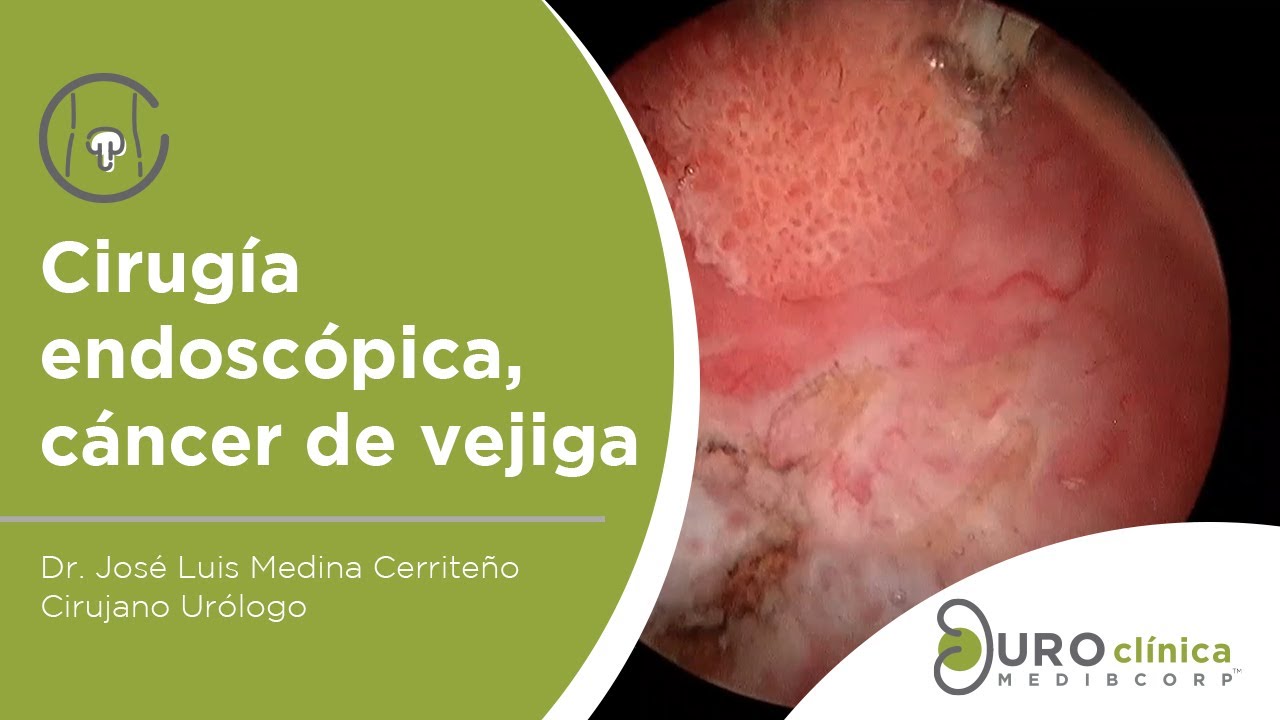 Luis Gerardo Medina Bucio-30