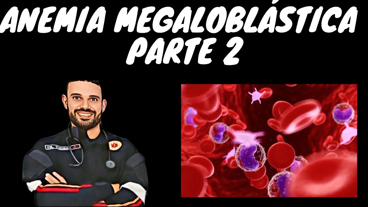 ANEMIA MEGALOBLASTICA - PARTE 2