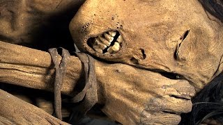 Mummies: scanning ancient human remains