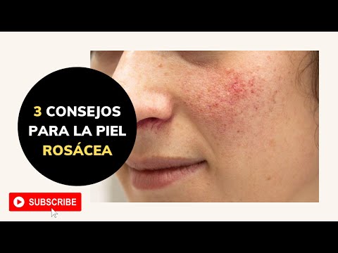 ROSÁCEA – TRES RECOMENDACIONES