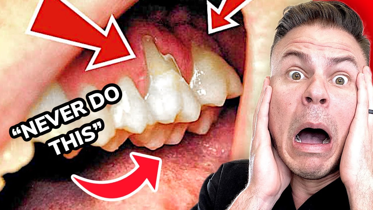 How much water do we need to brush your teeth? Tipseri