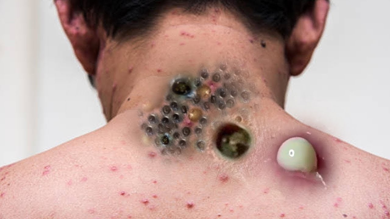 𝑺𝒐𝒐𝒕𝒉𝒊𝒏𝒈 𝑭𝒂𝒄𝒊𝒂𝒍 𝑻𝒓𝒆𝒂𝒕𝒎𝒆𝒏𝒕 𝑭𝒐𝒓 𝑺𝒕𝒓𝒆𝒔𝒔 𝑹𝒆𝒍𝒊𝒆𝒇 𝒂𝒕 𝑳𝒖𝒙𝒖𝒓𝒚 𝑺𝒑𝒂 𝑨𝒄𝒉𝒊𝒆𝒗𝒆 𝑰𝒏𝒏𝒆𝒓 𝑷𝒆𝒂𝒄𝒆 #887983