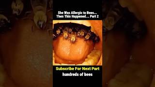She was allergic to bees...Then this happened..   Part 2 #shorts