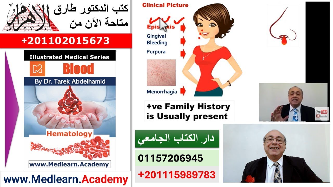 Von Willebrand disease (VWD) #cme #internal_medicine #medical #medicalstudent #usmle #محاضرات_باطنة