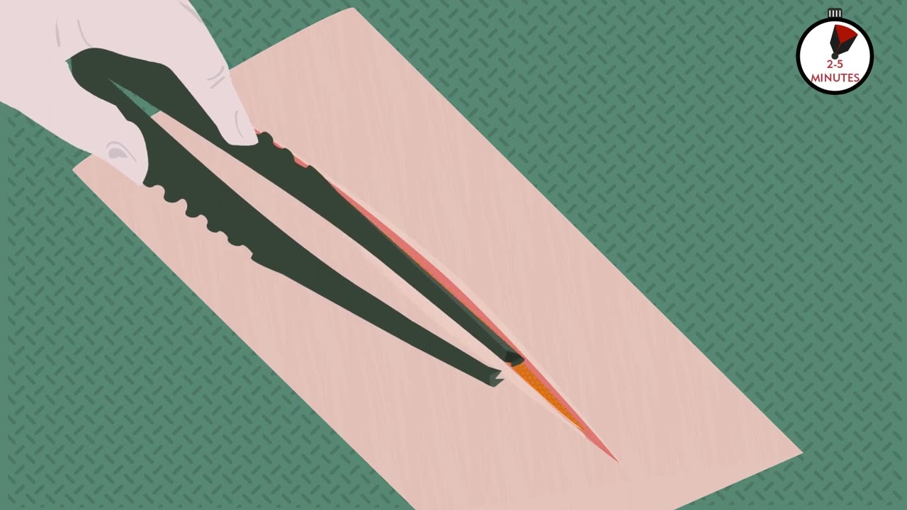 Medical Video -  009 Wound Treatment en